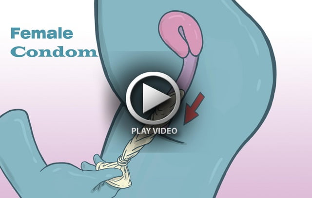 Use-a-Female-Condom-Step