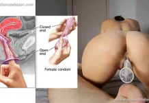 महिला कंडोम (Female condom) क्या है इसे उपयोग कैसे करते हैं महिला कंडोम गर्भनिरोधक Female condom Contraceptives क्या है उपयोग फायदे